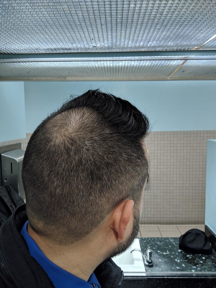 hair