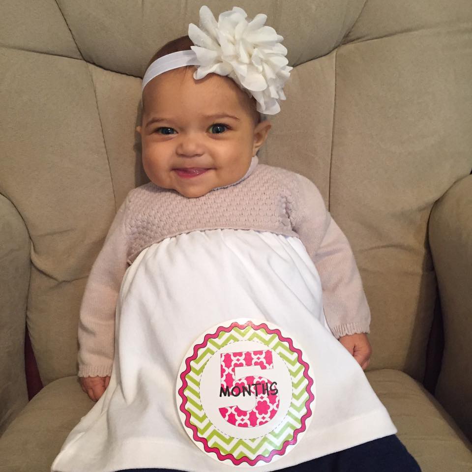 Months after birth parents start noticing baby’s skin turning yellow