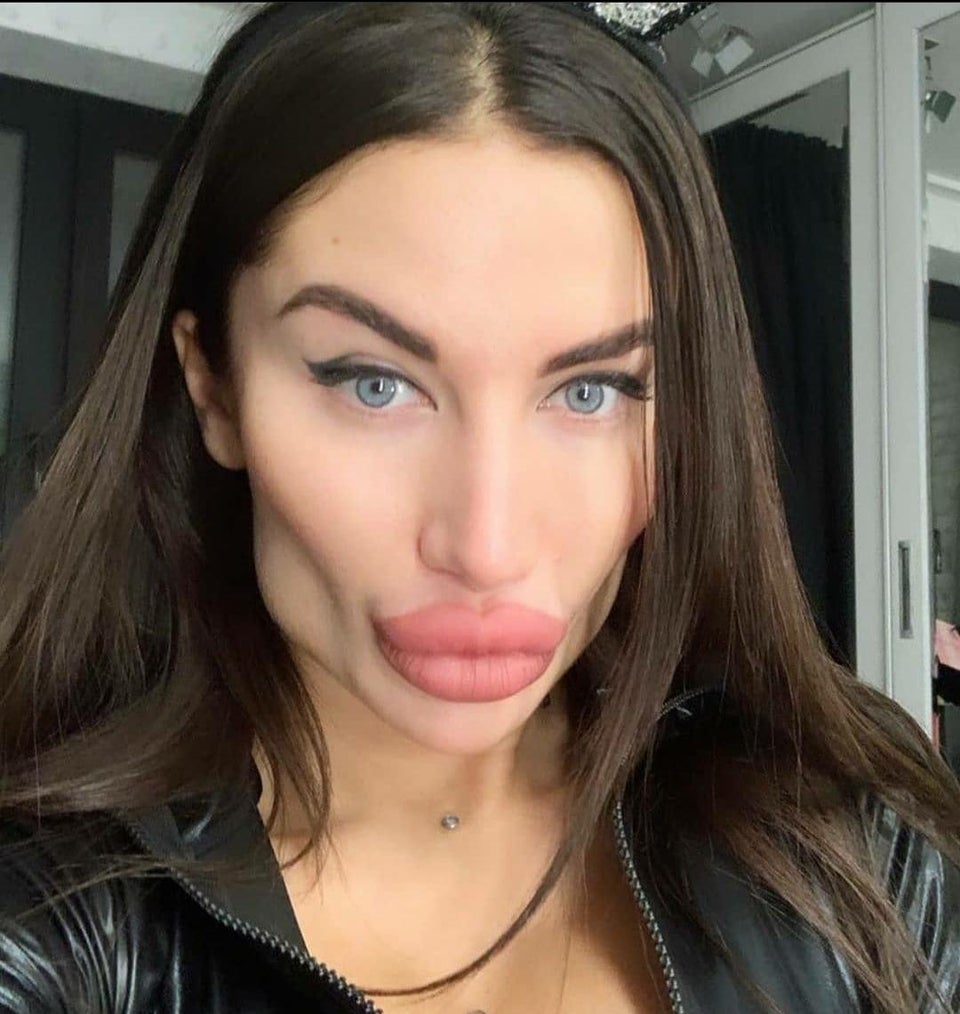 75 Plastic surgery jobs that made a mess of things